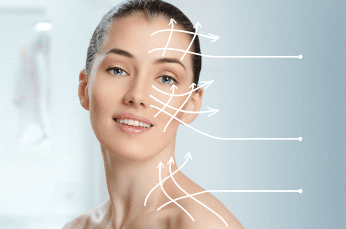 Melasma Lasers May Not Always Be The Most Effective