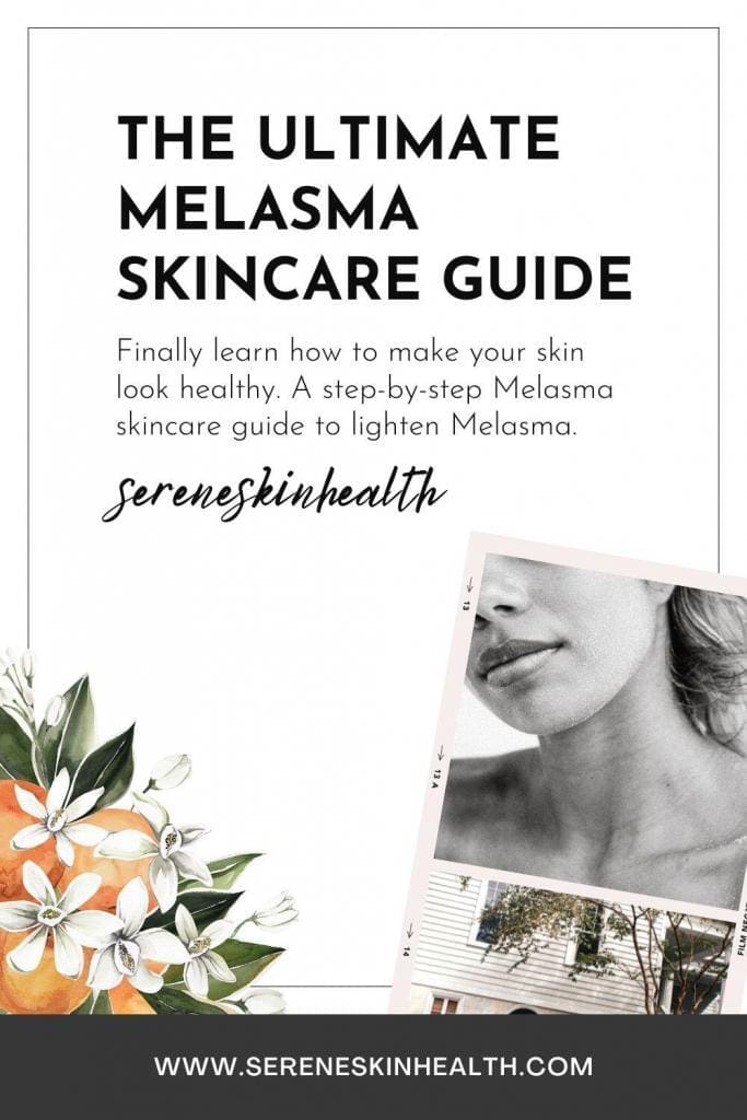 melasma skincare guide