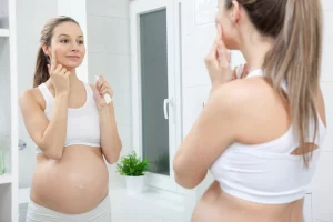 melasma during pregnancy