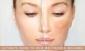 whiten skin naturally