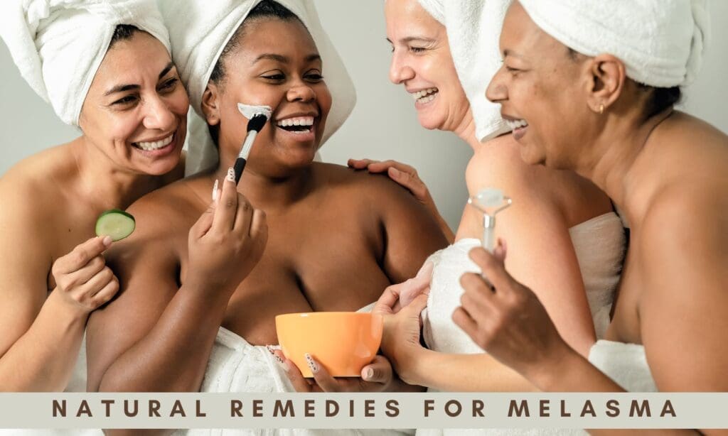 natural remedies for melasma